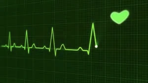 Cardiac arrest, electrocardiogram 1
